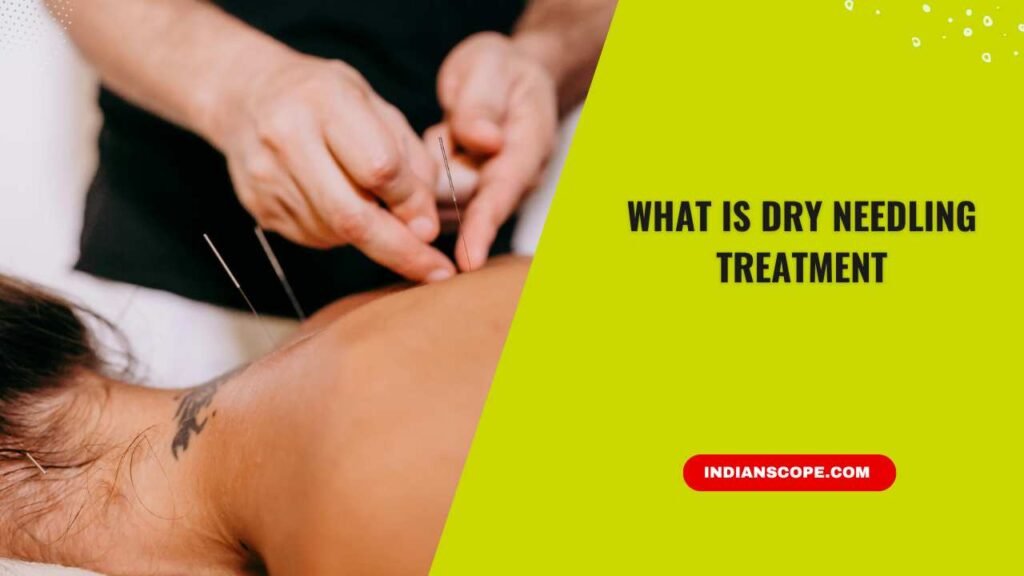 What Is Dry Needling Treatment